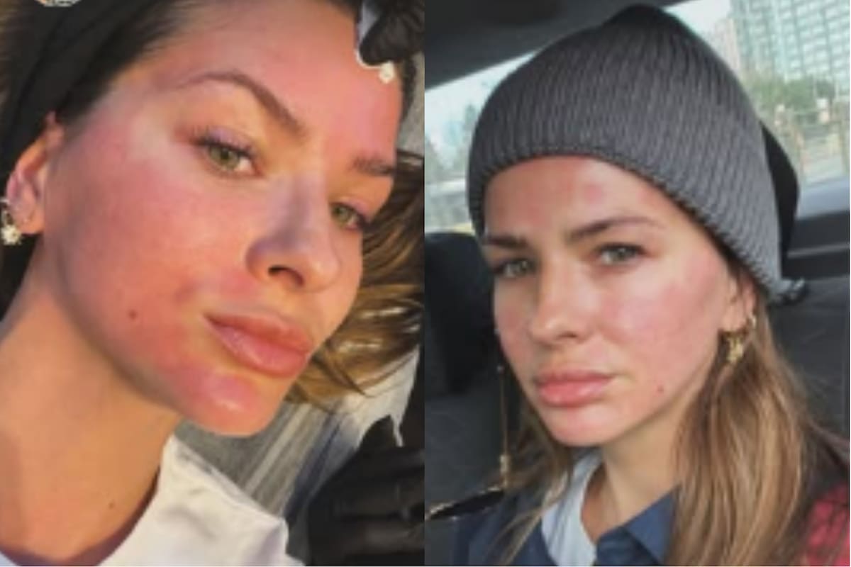 La China Suarez Se Hizo Un Retoque Estetico Y Xpdtrmdgffgspnmzuw5wya2twq.png